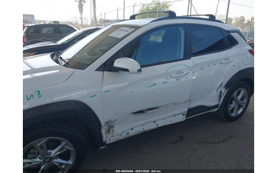 hyundai-kona-2-0l-i-4-dohc-vvt-147hp-front-wheel-drive - 5